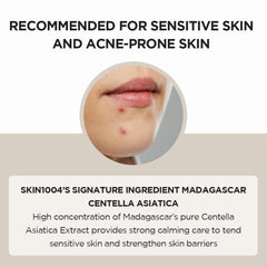 Skin 1004 Madagascar Centella Asiatica Ampoule