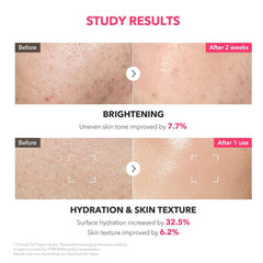 APRILSKIN TXA Niacinamide 99 Milky Toner 150ml