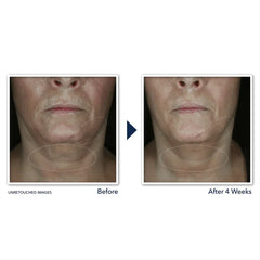 DERM CORREXION® Contour Cream