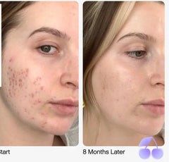 Topicals Faded Brightening Serum and clearing serum for Dark Spots & Discoloration 15ml. 50 ml